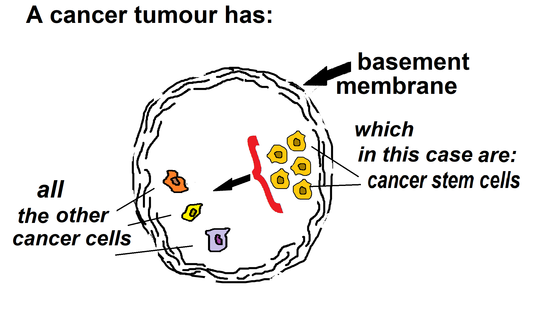 A cancer tumour has other cancer cells2add