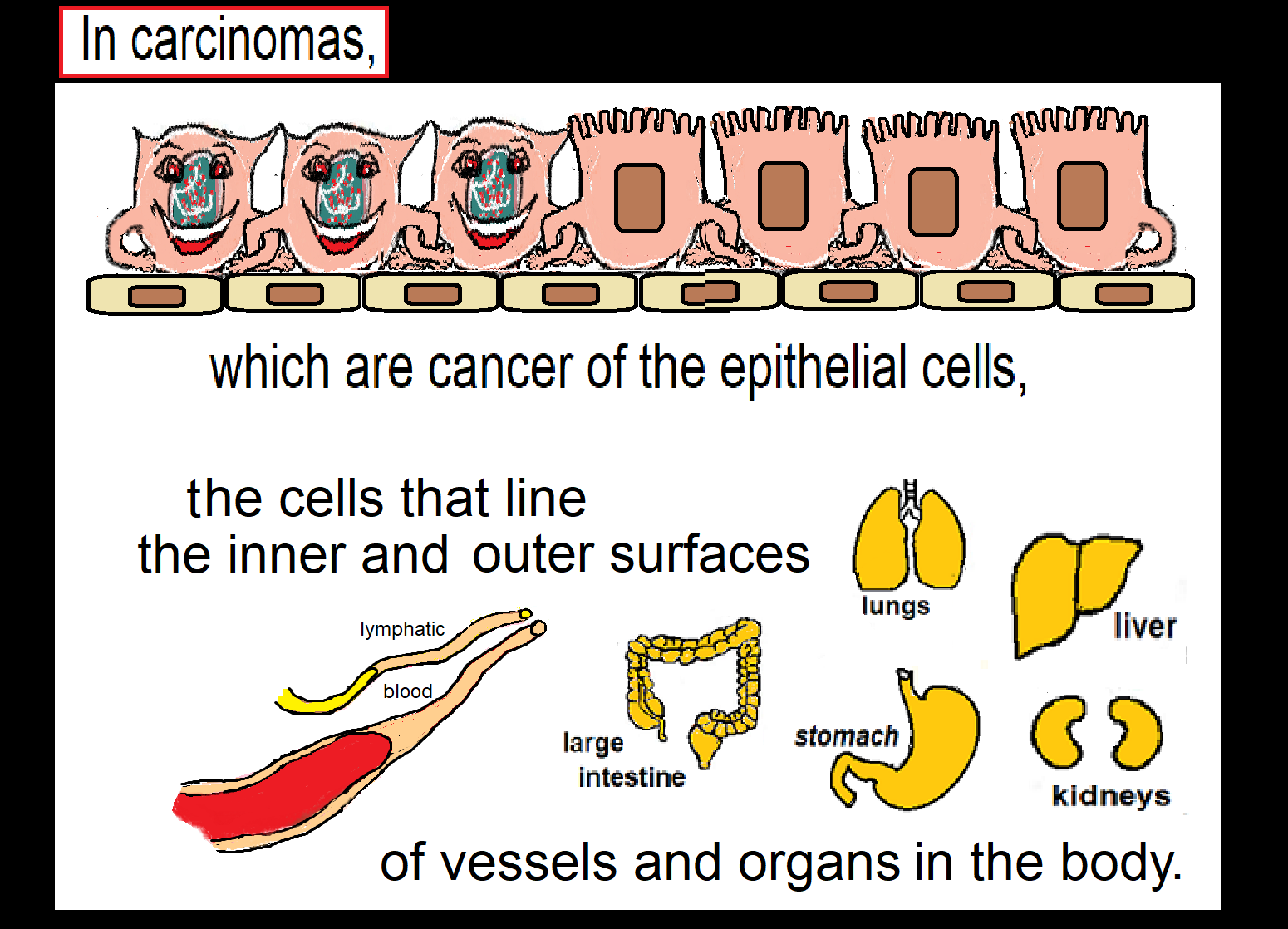 EMT cells of linings